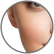 Botox fillers enhances cheek volume