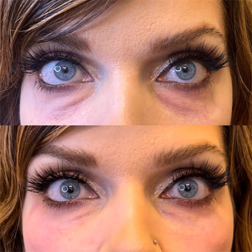 1_0000_PRF UNDER EYE .zip – 2_1.png