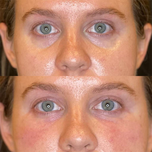 1_0001_PRF UNDER EYE .zip – 13_1.png