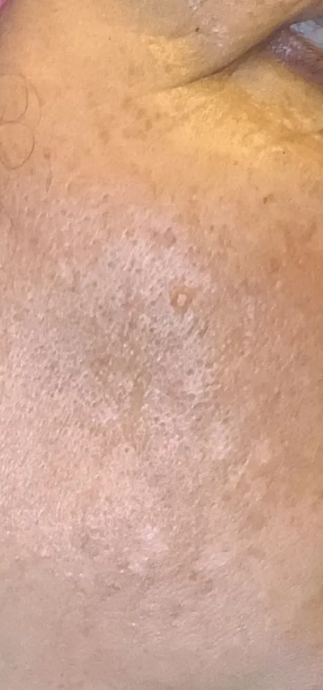 chem_1-2-1000×1000-before