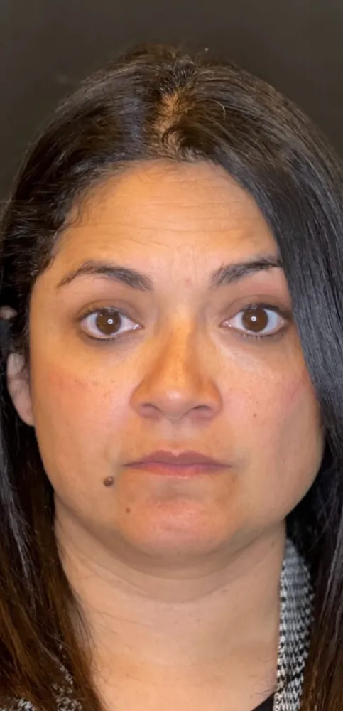 dermal_8-3-1000×1000-1of8