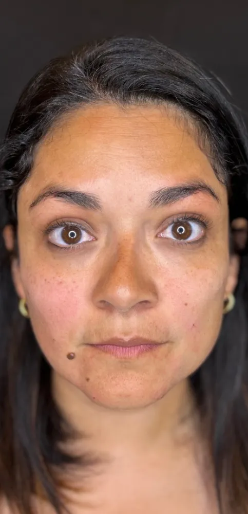 dermal_8-3-1000×1000-2of8