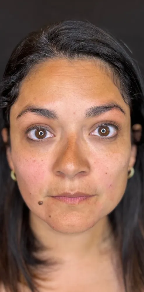 dermal_8-3-1000×1000-4of8