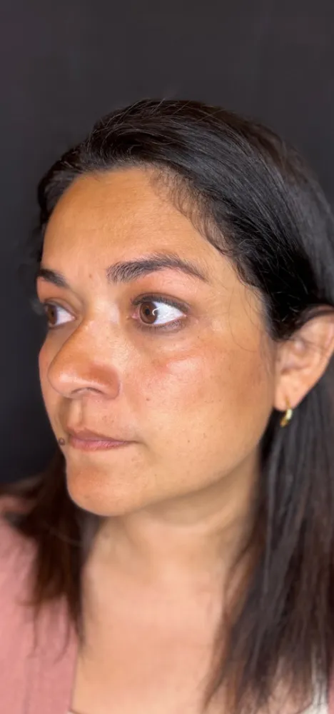 dermal_8-3-1000×1000-5of8