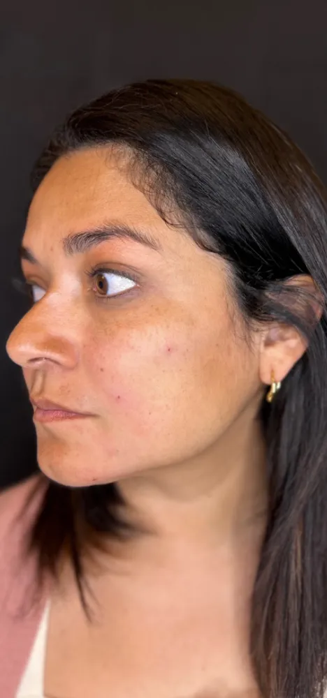 dermal_8-3-1000×1000-6of8