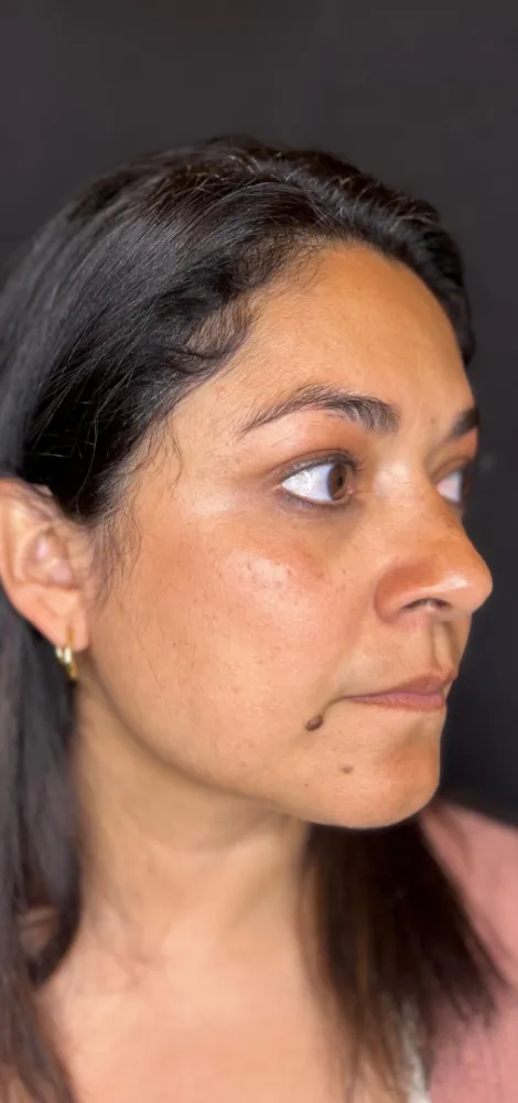 dermal_8-3-1000×1000-7of8