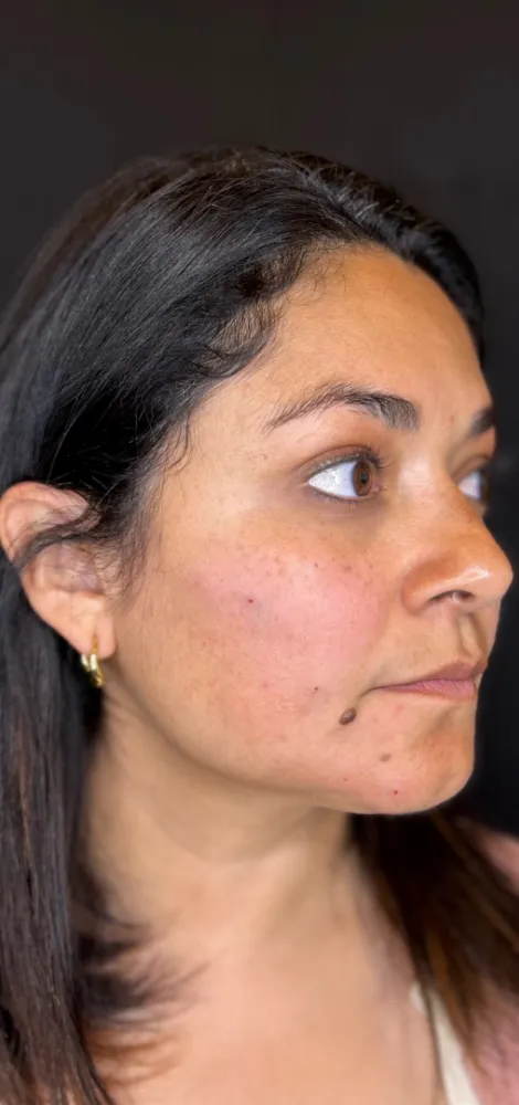 dermal_8-3-1000×1000-8of8